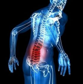 Osteocondrosis