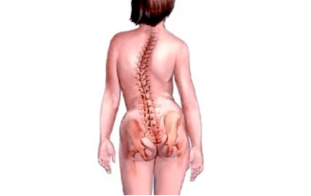 Razones para el desarrollo de osteocondrosis cervical.