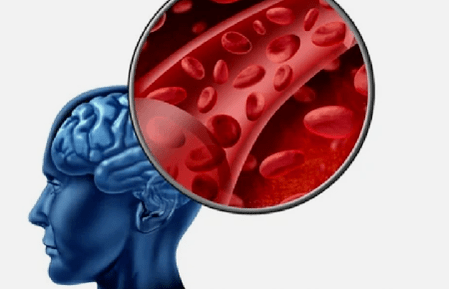 Síntomas de osteocondrosis de la columna cervical.