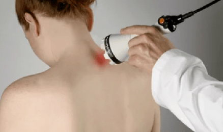 Tratamiento de la osteocondrosis cervical con métodos fisioterapéuticos.