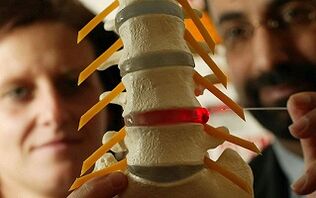 Síntomas y tratamiento de la osteocondrosis de la columna torácica
