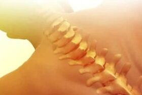 Osteocondrosis como tratar